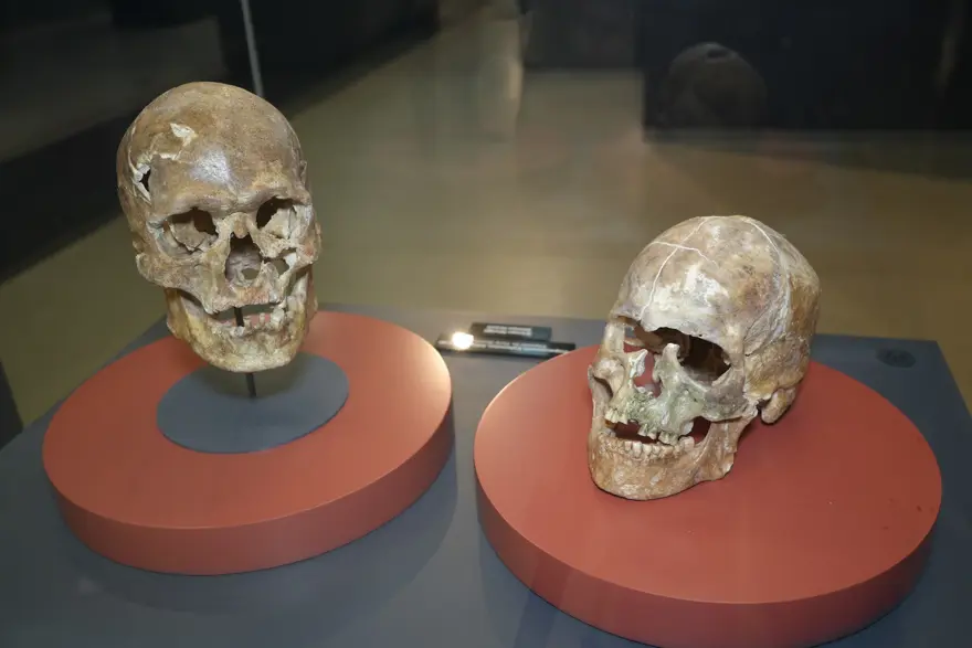 A 5,000-Year-Old Skull Reveals One of the Earliest Medical Interventions in Anatolia